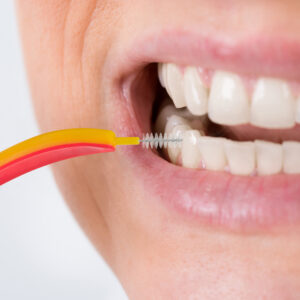 Interdental